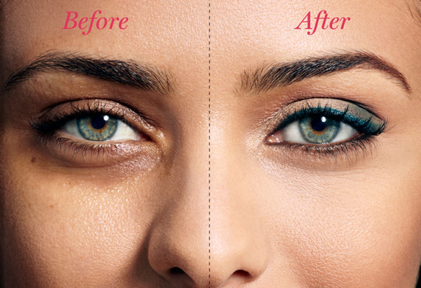 Easy ways to get rid of dark circles under your eyes